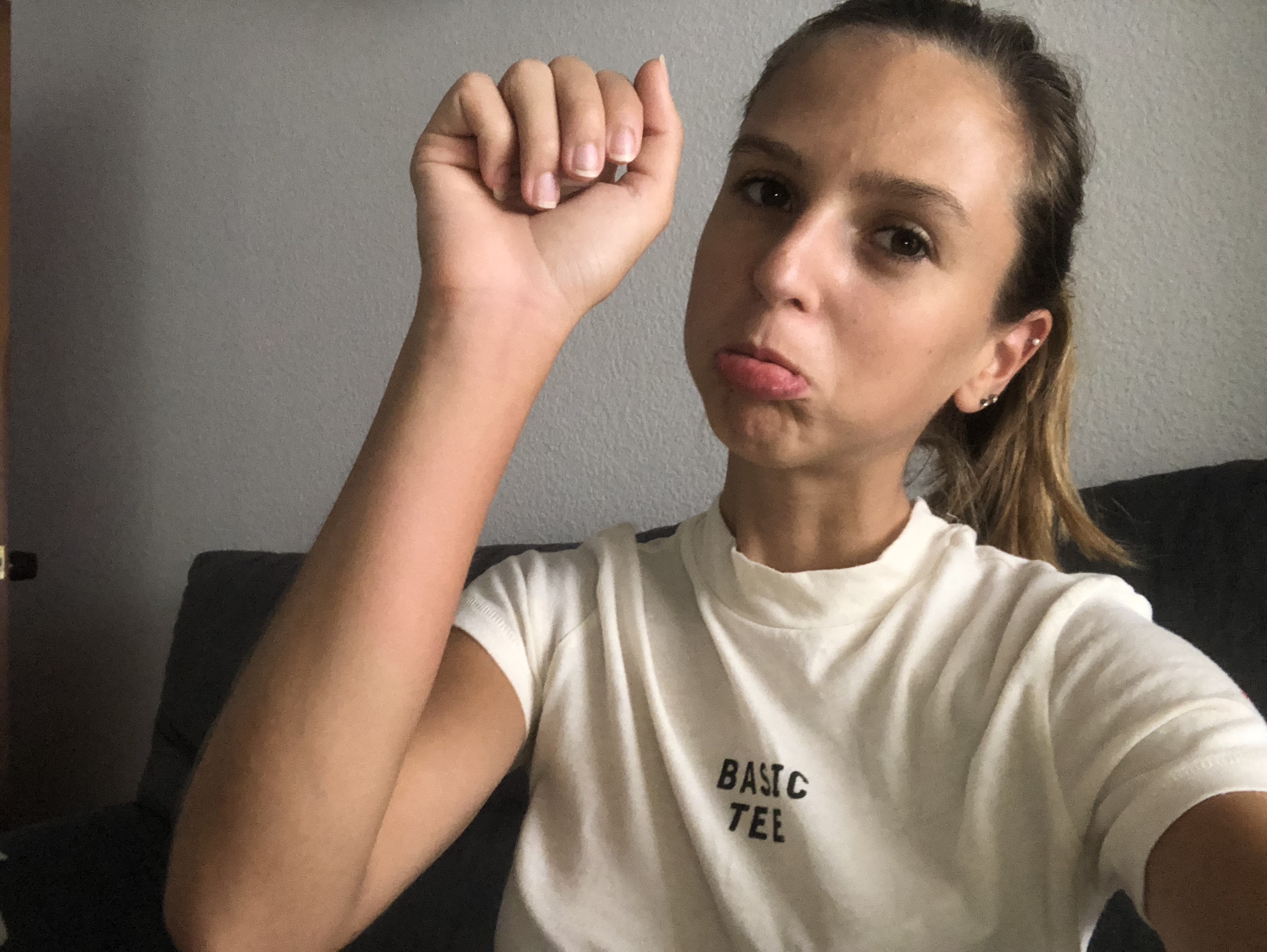 sad face wasp sting on arm wearing bershka